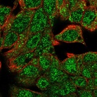 Anti-HHEX Antibody