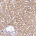 Anti-MIA2 Antibody