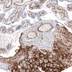Immunohistochemical staining of human placenta shows strong membranous positivity in decidual cells, as well as positivity in endothelial cells.