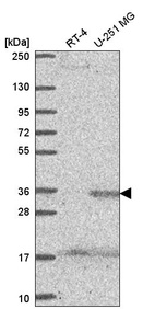 Anti-SPRY4 Antibody