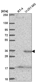 Anti-SPRY4 Antibody