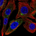 Immunofluorescent staining of human cell line PC-3 shows localization to cytosol & the Golgi apparatus.