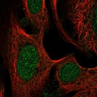 Anti-SWI5 Antibody