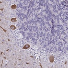 Anti-CHD5 Antibody