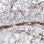 Anti-MCAM Antibody