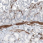 Immunohistochemical staining of human duodenum shows strong cytoplasmic positivity in smooth muscle cells.