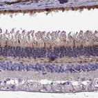 Anti-GUCA1B Antibody