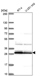 Western blot analysis in human cell line RT-4 and human cell line U-251 MG.