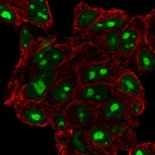 Anti-DPH6 Antibody
