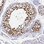 Anti-SNRPC Antibody