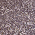 Immunohistochemical staining of human lymph node shows moderate nuclear positivity in non-germinal center cells.
