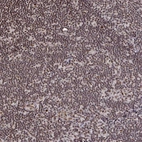 Immunohistochemical staining of human lymph node shows moderate nuclear positivity in non-germinal center cells.