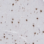 Anti-SNRPC Antibody