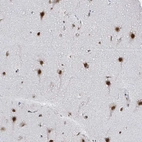 Immunohistochemical staining of human cerebral cortex shows strong nuclear positivity in neurons.