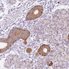 Anti-PLPP2 Antibody