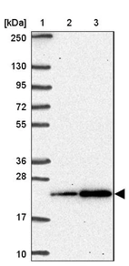 Lane 1: Marker [kDa] 250, 130, 95, 72, 55, 36, 28, 17, 10_br/_Lane 2: Human cell line RT-4_br/_Lane 3: Human cell line U-251 MG