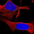Immunofluorescent staining of human cell line U-2 OS shows localization to mitochondria.