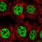 Immunofluorescent staining of human cell line MCF7 shows localization to nucleoplasm.