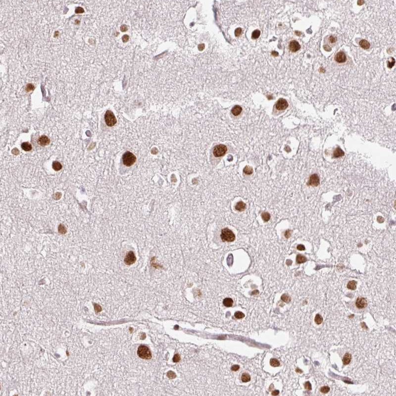 Anti-RIPPLY3 Antibody