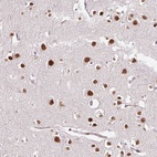 Anti-RIPPLY3 Antibody