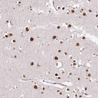 Anti-RIPPLY3 Antibody