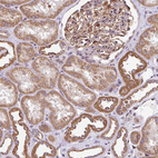 Anti-FIGNL1 Antibody