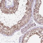 Anti-FIGNL1 Antibody