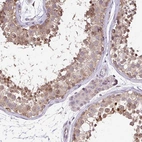 Immunohistochemical staining of human testis shows moderate cytoplasmic positivity in spermatocytes.