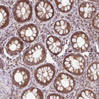 Immunohistochemical staining of human rectum shows moderate granular cytoplasmic positivity in glandular cells.