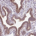Immunohistochemical staining of human fallopian tube shows moderate cytoplasmic positivity in glandular cells.