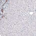 Anti-MCAM Antibody