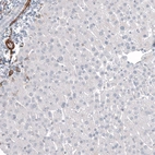 Immunohistochemical staining of human liver shows no positivity in hepatocytes as expected.