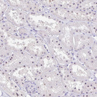 Anti-FTSJ3 Antibody