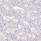 Anti-FTSJ3 Antibody