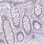 Immunohistochemical staining of human rectum shows strong nuclear positivity in glandular cells.