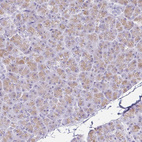 Anti-FTSJ3 Antibody