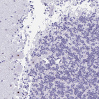 Immunohistochemical staining of human cerebellum shows strong nuclear positivity in Purkinje cells.