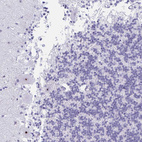 Anti-FTSJ3 Antibody