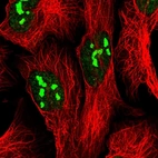 Immunofluorescent staining of human cell line U-2 OS shows positivity in nucleus & nucleoli.