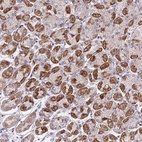 Anti-ERI1 Antibody