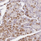 Anti-EPN3 Antibody