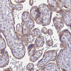 Immunohistochemical staining of human placenta shows strong cytoplasmic positivity in trophoblastic cells.