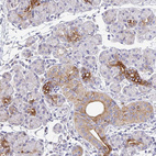 Anti-EPN3 Antibody