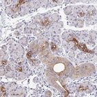 Immunohistochemical staining of human salivary gland shows strong cytoplasmic positivity in glandular cells.