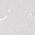Immunohistochemical staining of human skeletal muscle shows no positivity in myocytes as expected.