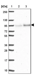 Lane 1: Marker [kDa] 250, 130, 95, 72, 55, 36, 28, 17, 10_br/_Lane 2: Human cell line RT-4_br/_Lane 3: Human cell line U-251MG sp