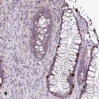 Immunohistochemical staining of human rectum shows strong positivity in nucleoli in glandular cells.