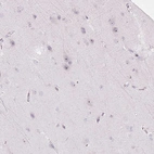 Immunohistochemical staining of human cerebral cortex shows moderate to strong positivity in nucleoli in a subset of neurons.