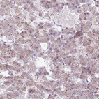 Anti-RRS1 Antibody