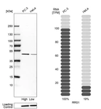 Western blot analysis in human cell lines PC-3 and HeLa using Anti-RRS1 antibody. Corresponding RRS1 RNA-seq data are presented for the same cell lines. Loading control: Anti-HSP90B1.